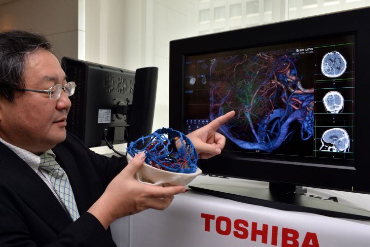10分钟完成医师1日数据整理 富士3D模拟帮手术导航
