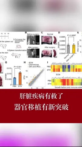 肝脏疾病有救了，器官移植有新突破肝脏 疾病 移植 器官